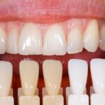 خردی آنلاین کامپوزیت