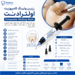 خرید رزین کامپوزیت وتینگ